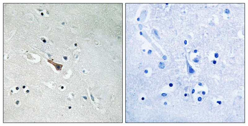 APLP2 (Phospho-Tyr755)
