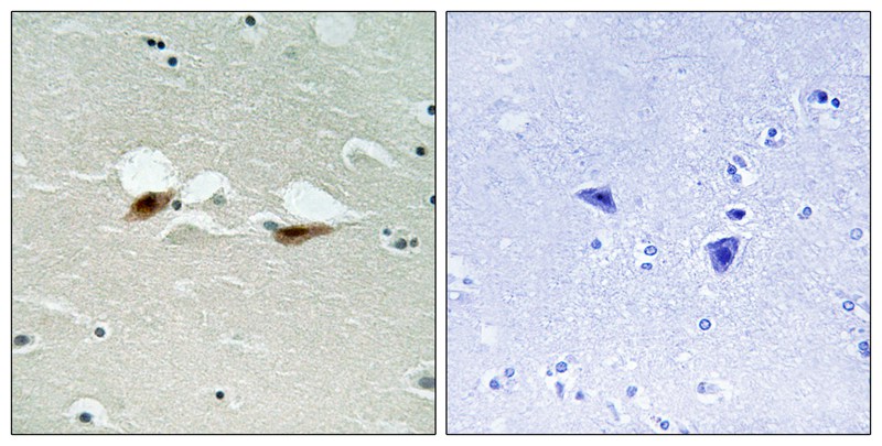 ATF-2 (Phospho-Ser472)