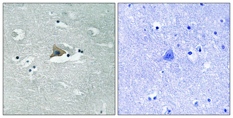 Claudin 5 (Phospho-Tyr217)