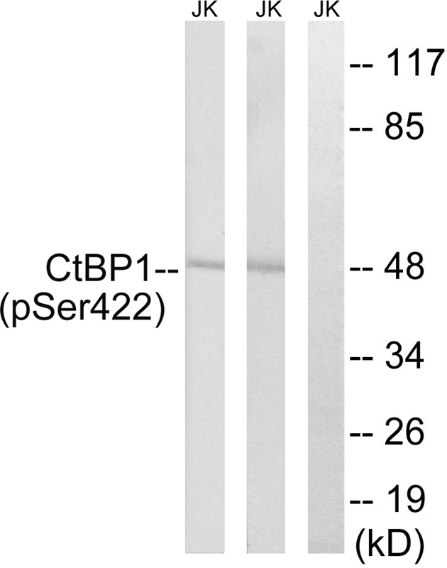 CtBP1 (Phospho-Ser422)