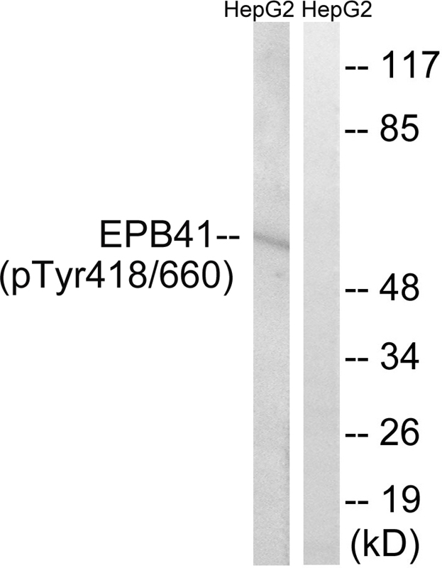 EPB41 (Phospho-Tyr660/418)