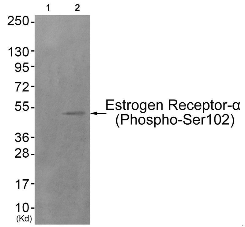 Estrogen Receptor-α (Phospho-Ser102)