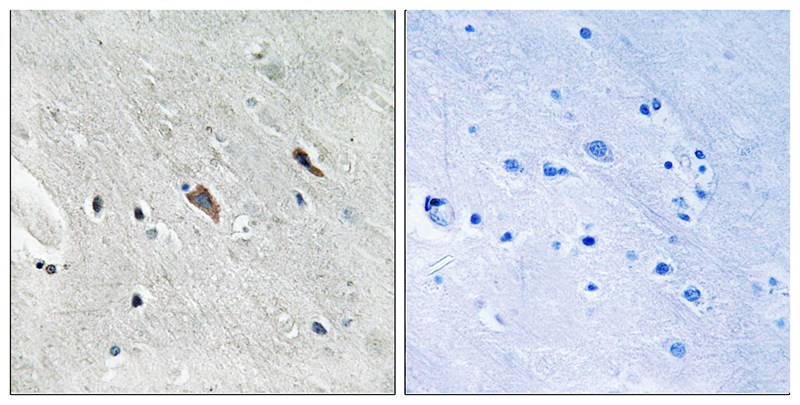 Rabbit Polyclonal Antibody to Gab2 (Phospho-Tyr643)