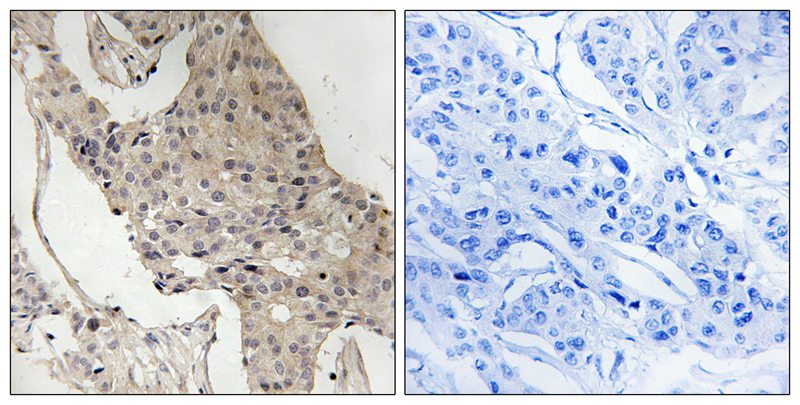 Rabbit Polyclonal Antibody to Gab2 (Phospho-Ser623)