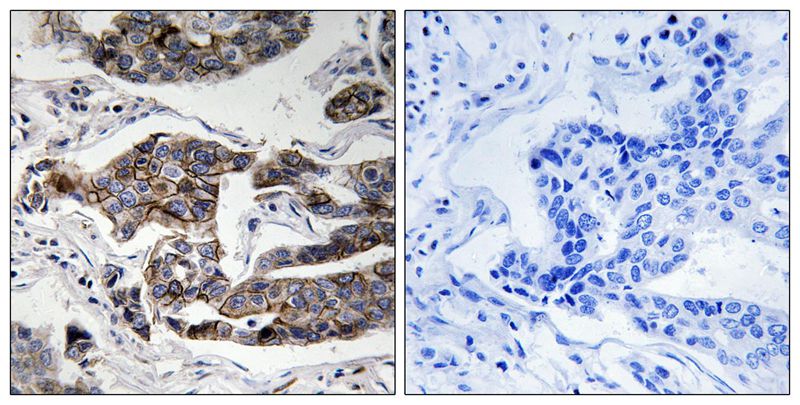 Girdin (Phospho-Ser1417)