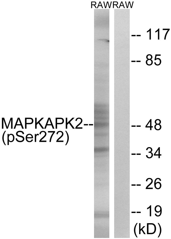 MAPKAPK2 (Phospho-Ser272)