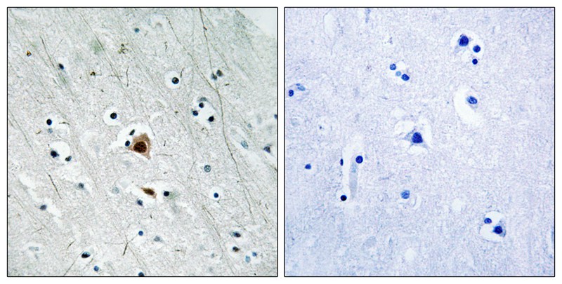 Rabbit Polyclonal Antibody to MAPKAPK2 (Phospho-Ser272)
