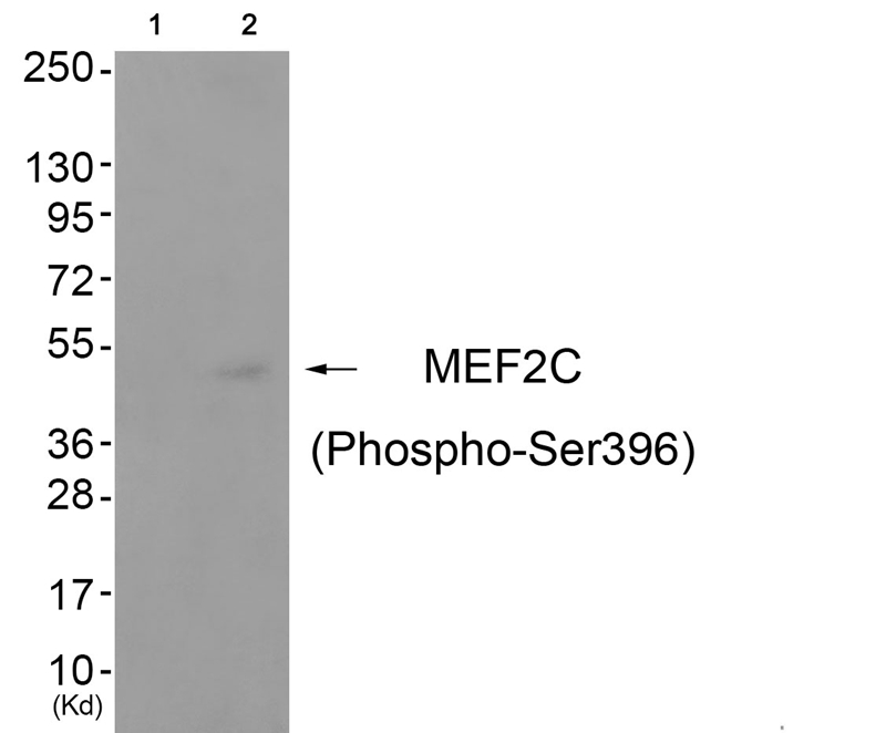 MEF2C (Phospho-Ser396)