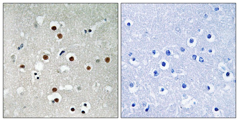 Rabbit Polyclonal Antibody to MEF2C (Phospho-Ser396)