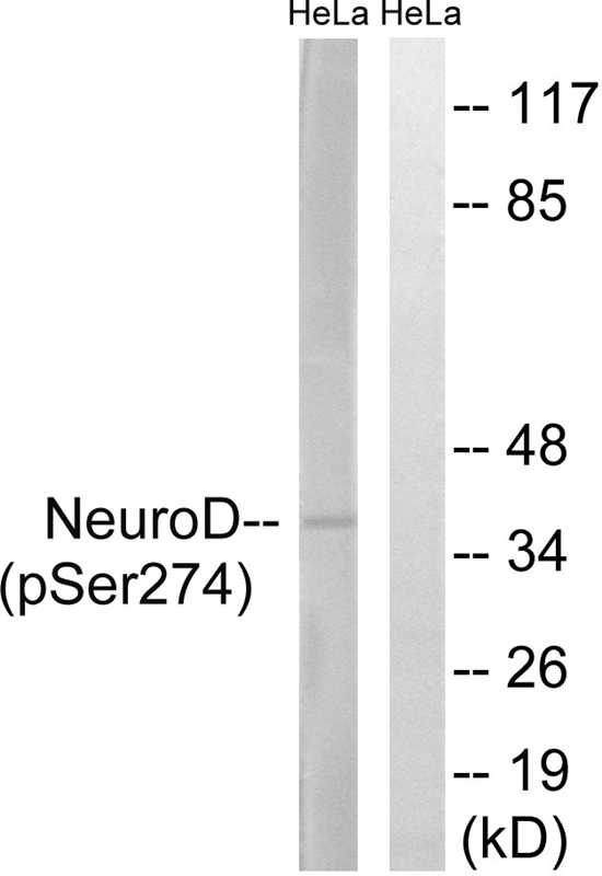 Neuro D (Phospho-Ser274)