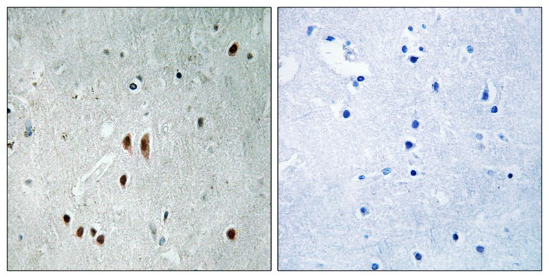 CNOT2 (Phospho-Ser101)