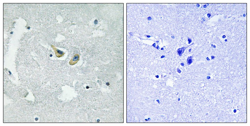 Rabbit Polyclonal Antibody to p47 phox (Phospho-Ser345)