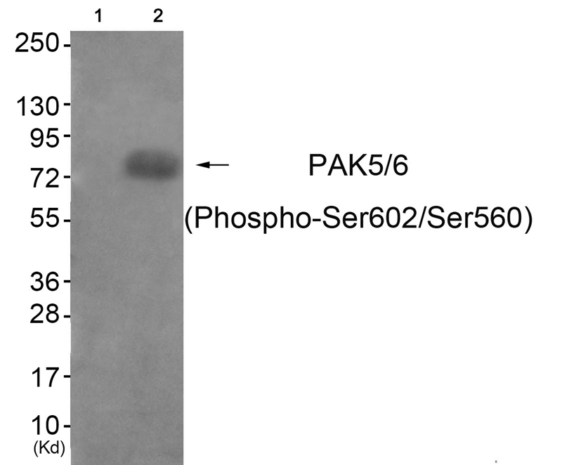 PAK5/6 (Phospho-Ser602/Ser560)
