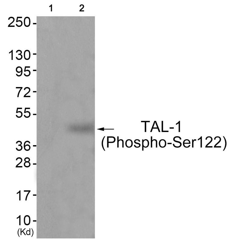 TAL-1 (Phospho-Ser122)