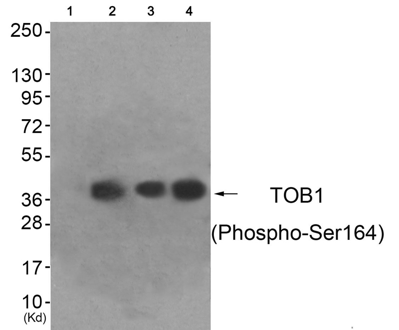 TOB1 (Phospho-Ser164)