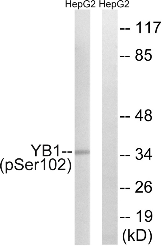 YB1 (Phospho-Ser102)