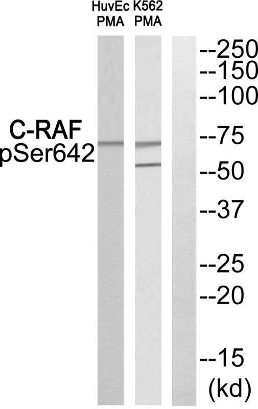 C-RAF (Phospho-Ser642)