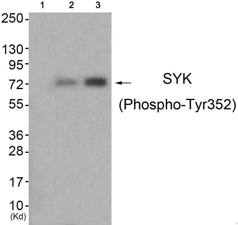 SYK (Phospho-Tyr352)