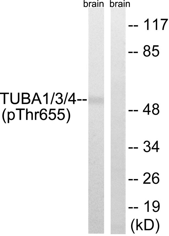 TUBA1/3/4 (Phospho-Tyr272)