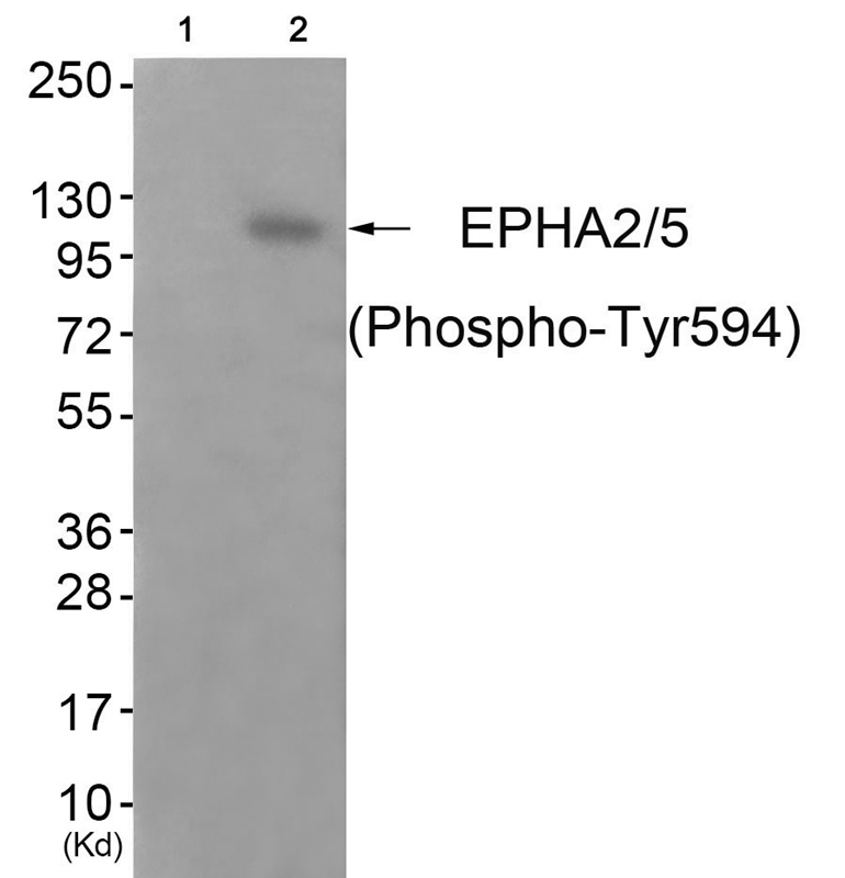 EPHA2/5 (Phospho-Tyr594)