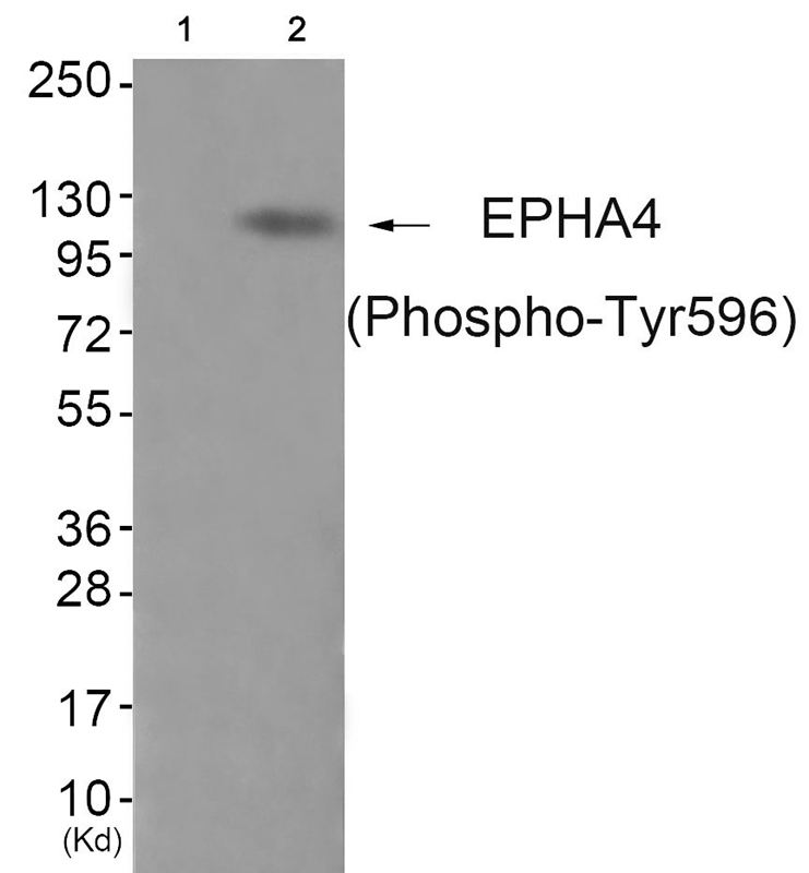 EPHA4 (Phospho-Tyr596)
