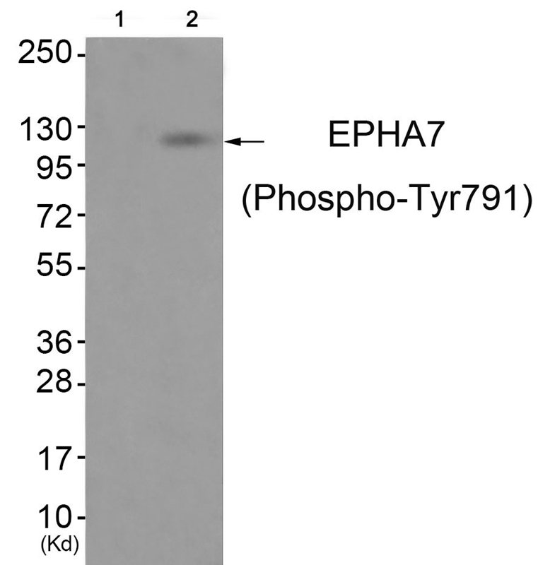EPHA7 (Phospho-Tyr791)