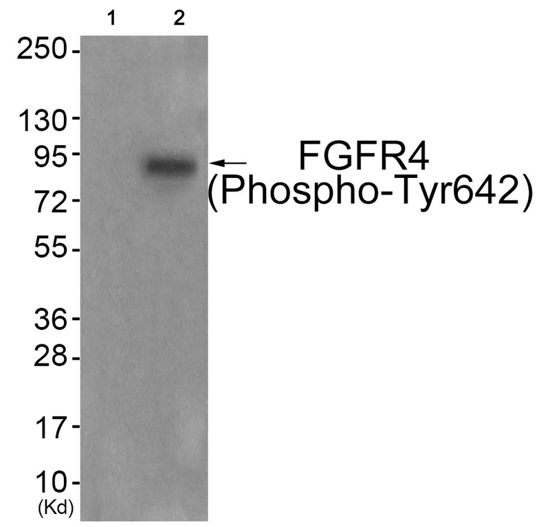 FGFR4 (Phospho-Tyr642)