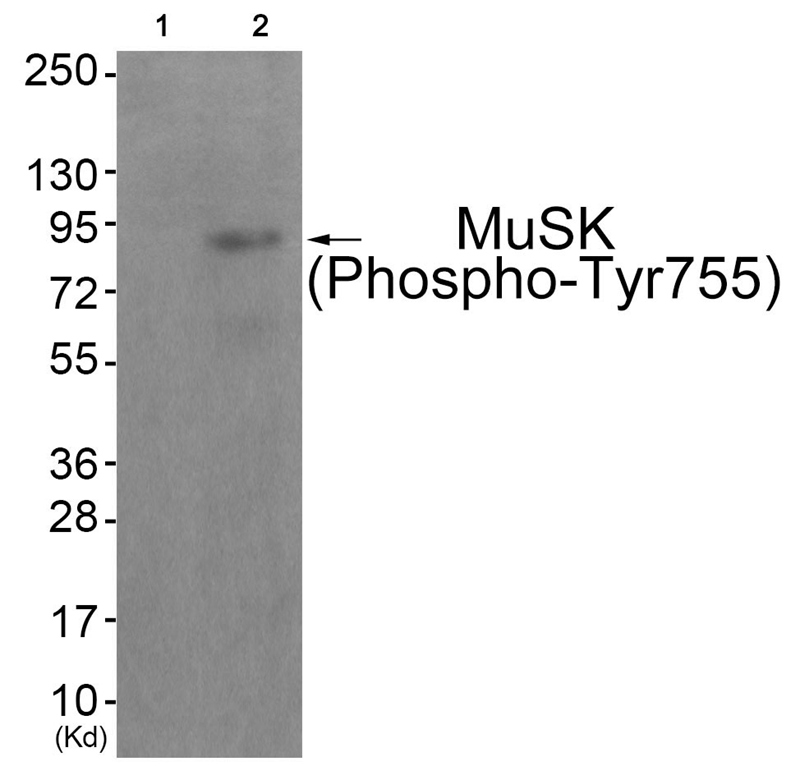 MuSK (Phospho-Tyr755)