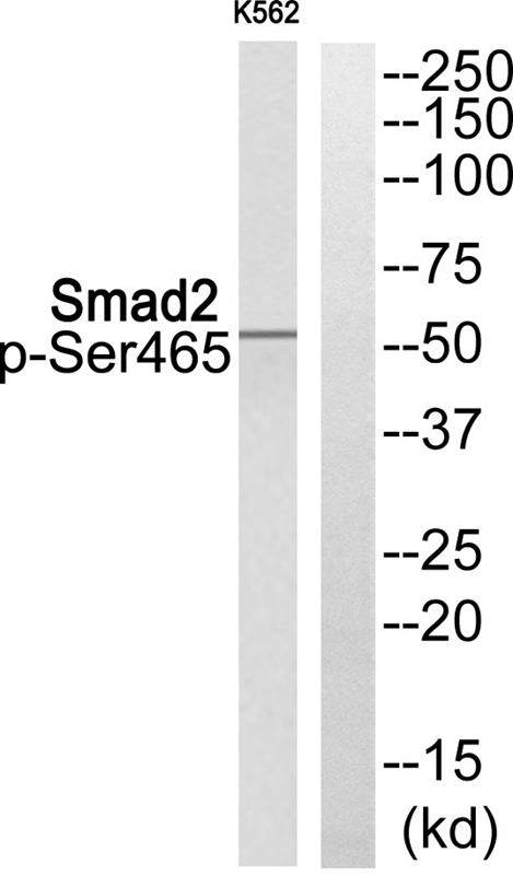 Smad2 (Phospho-Ser465)