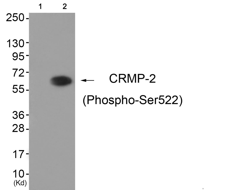 CRMP-2 (Phospho-Ser522)