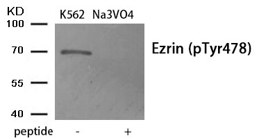 Ezrin (Phospho-Tyr478)