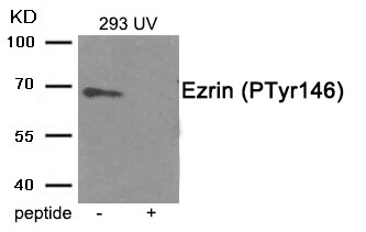Ezrin (Phospho-Tyr146)