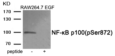 NF-κB p10(Phospho-Ser872)