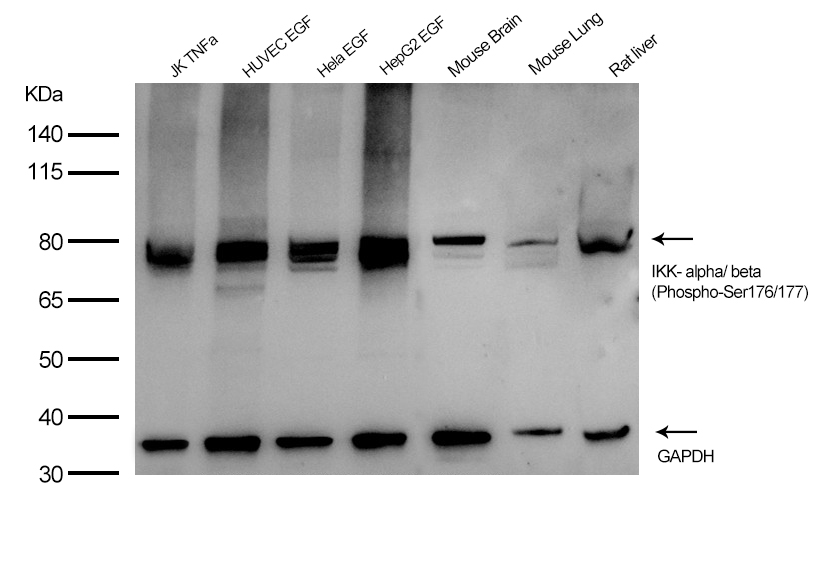 IKK- alpha/ beta (Phospho-Ser176/177)