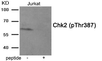Chk2 (Phospho-Thr387)