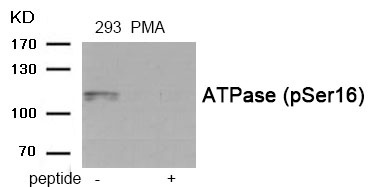 ATPase (Phospho-Ser16)