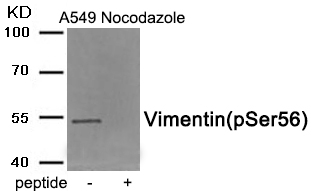 Vimentin (Phospho-Ser56)