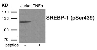 SREBP-1 (Phospho-Ser439)
