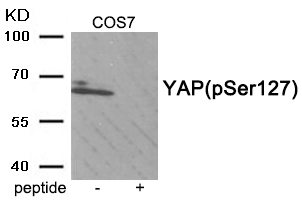 YAP (Phospho-Ser127)
