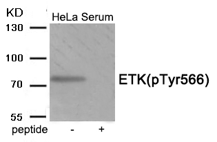 ETK (Phospho-Tyr566)