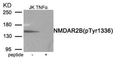 NMDAR2B (Phospho-Tyr1336)