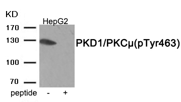 PKD1/PKC μ (Phospho-Tyr463)