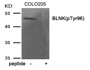BLNK (Phospho-Tyr96)