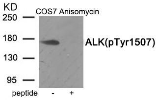 ALK (Phospho-Tyr1507)