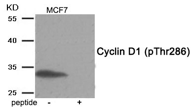 Cyclin D1 (Phospho-Thr286)