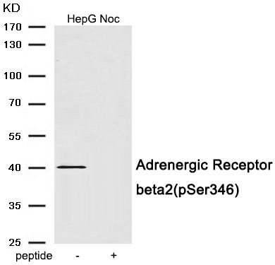 Adrenergic Receptor beta2 (Phospho-Ser346)