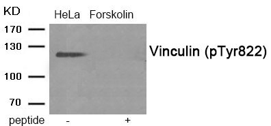 Vinculin (Phospho-Tyr822)