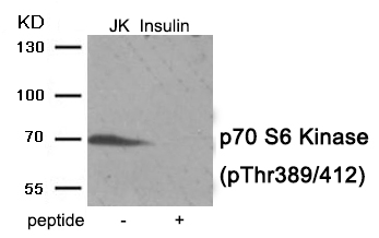 p7S6 Kinase (Phospho-Thr389/412)