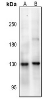 NMDAR1 (Phospho-Ser890)