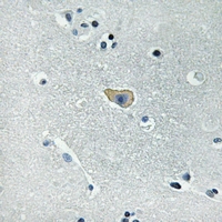 Rabbit Polyclonal Antibody to NMDAR1 (Phospho-Ser890)